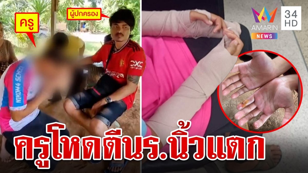 ครูร่ำไห้กราบขอโทษพ่อเด็ก ม.3 หลังใช้ไม้เรียวตีมือจนนิ้วแตกต้องใส่เฝือก