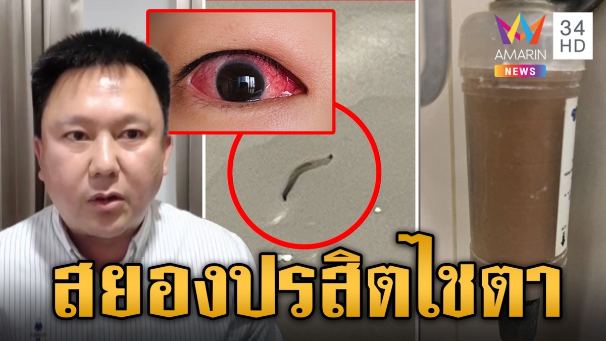 เปิดสาเหตุปรสิตโผล่น้ำคอนโดหรู ไชตาลูกบ้านนับ 100 หวิดบอด