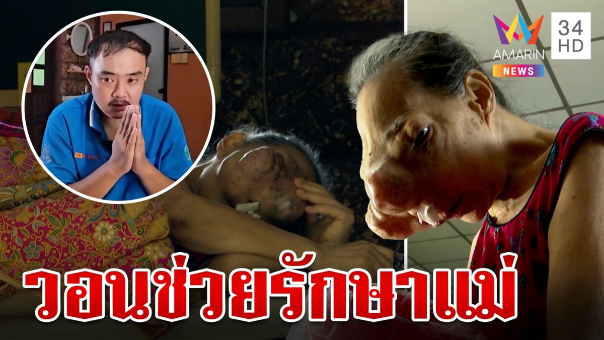รันทด!ลูกวอนช่วยรักษาแม่ป่วยเนื้องอกจมูก ลุกลามทำตาบอด