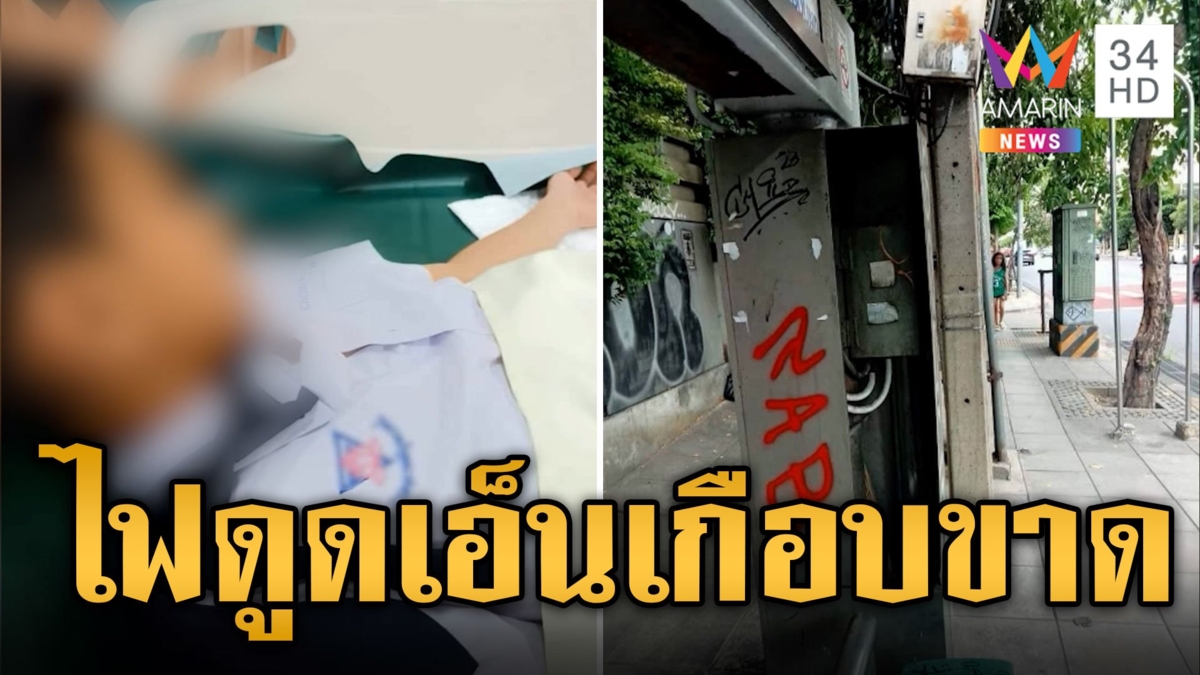 โดนไฟดูด สะบัดมือหนีโดนขอบตู้เอ็นนิ้วเกือบขาด