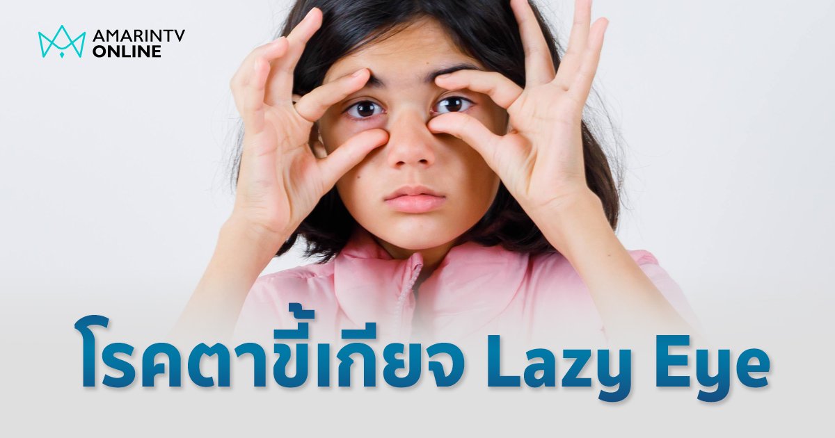 "โรคตาขี้เกียจ" ภาวะมองเห็นไม่ชัดที่พบบ่อยในเด็ก พ่อแม่รีบเช็กอาการเสี่ยง ก่อนรักษาไม่หาย