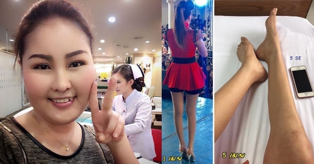ใจยังสู้! อัพเดทอาการป่วย 'หญิงลี' ทรุดหนัก ขาลีบเล็กเท่าสมาร์ทโฟน