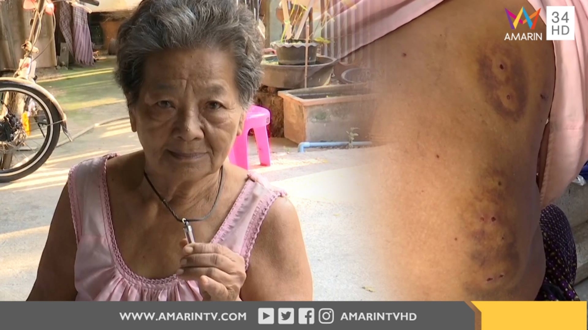 รอดปาฏิหาริย์! ยายวัย 75 ถูกกระหน่ำยิง เชื่อตะกรุด อ.อ๊อด (คลิป)