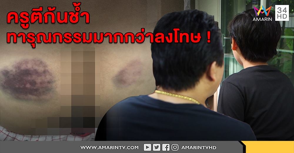 ครูโหดดาบไม้หวายหวดก้นนร.- เด็กป.6 ช้ำใจครูไม่ฟังเหตุผล พ่อถามนี่ลงโทษหรือทารุณ (คลิป)