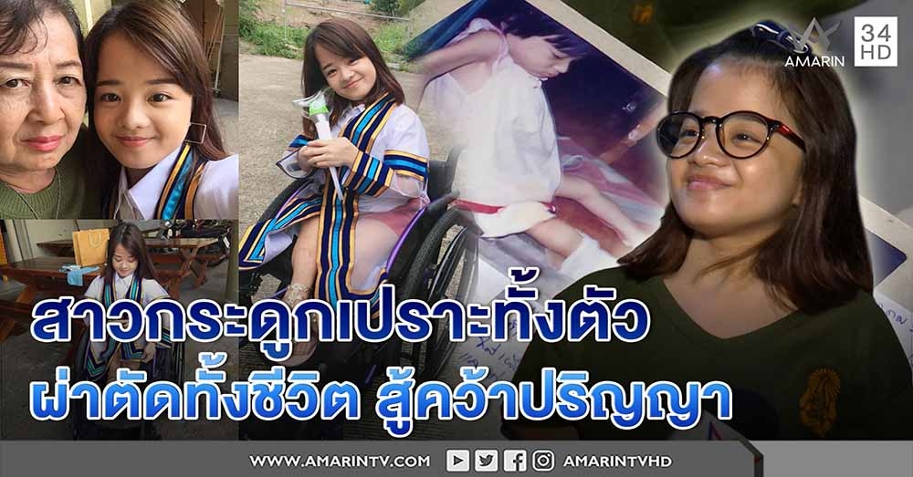 เปิดใจ "น้องจ๊ะจ๋า" กระดูกเปราะทั้งร่าง แม่ทิ้งแต่เกิด ผ่าตัดทั้งชีวิต สู้จนจบปริญญา (คลิป)