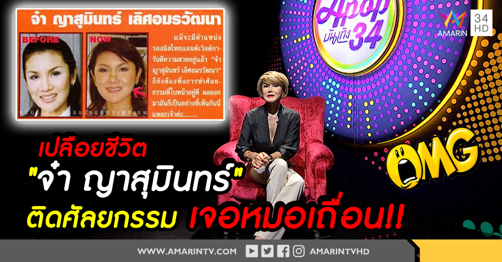 “จ๋า ญาสุมินทร์” เครียด! จากพิษศัลยกรรม ลดความมั่นใจในวงการ