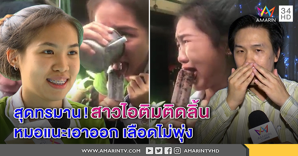 สุดทรมาน! สาวน้อยไอติมติดลิ้น รับสุดเจ็บคานาน 5 นาที - หมอแนะทำอย่างไร กันเลือดพุ่ง (คลิป)