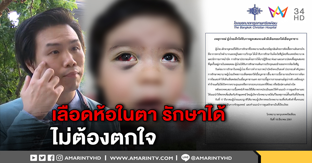 แพทย์ ชี้ปม 3 ขวบ ตาห้อเลือด ไอจามแรงขณะดูดเสมหะ แนะวิธี 1 สัปดาห์หาย (คลิป)