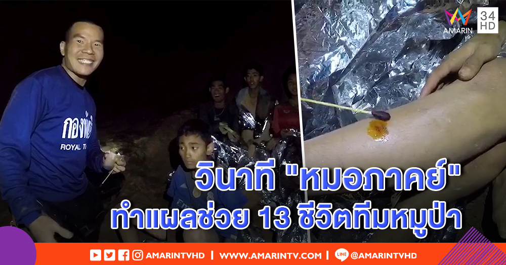 รู้จัก "หมอภาคย์" ทหารแกร่งแห่งปฐพี หนึ่งความหวังร่วมช่วยทีมหมูป่า - เผยภาพทำแผลให้เด็ก (คลิป)