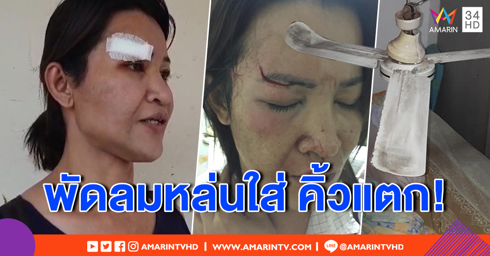 หวาดเสียว! สาว 2 โพสต์อุทาหรณ์ พัดลมร่วงเพดาน นอนเจ็บเย็บ 10 เข็ม (คลิป)