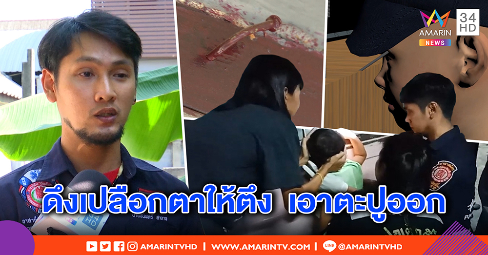 เปิดนาทีช่วยระทึก! ตะปูเสียบตาเด็ก 3 ขวบ เหยียบหมอนพลาด กู้ภัย อึ้ง หวิดตาบอด (คลิป)