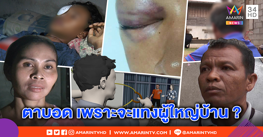 พยานแฉ เด็กตาบอดถูกหนังสติ๊กยิงใส่ กร่างคว้ามีดจ้วงผู้ใหญ่บ้านก่อน (คลิป)