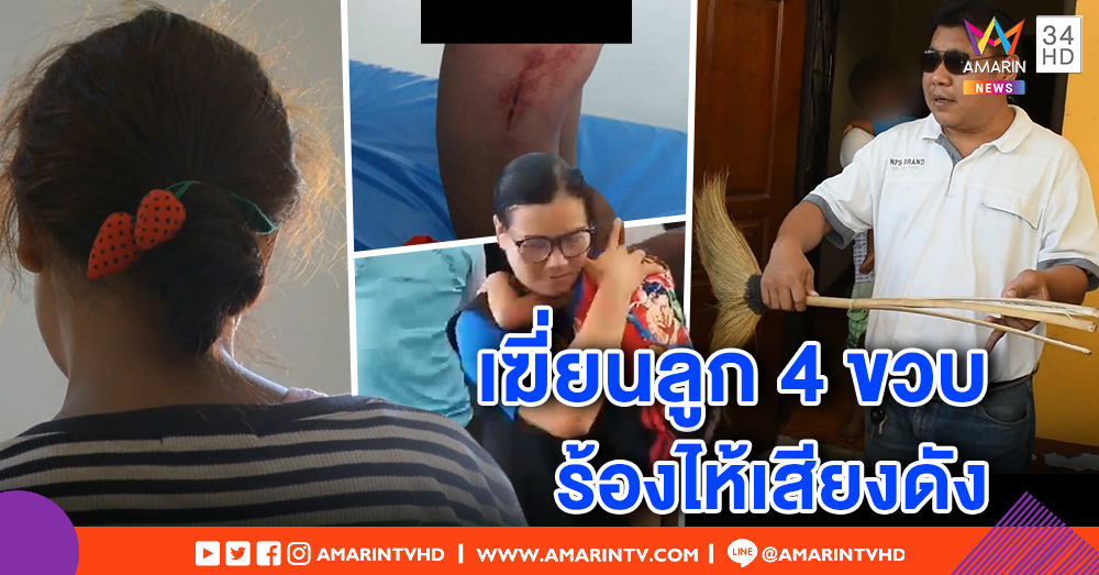 แม่เครียด! ลูก 4 ขวบร้องไห้เสียงดัง ไม้กวาดตีไม่ยั้งมือ ผัวห้ามโดนกัดแขน - บ้านพักเด็กเข้าช่วย