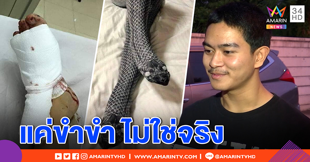 หนุ่มโพสต์ตีขาแฟนใส่ถุงน่องงูขาหัก ยอมรับไม่ใช่เรื่องจริง ยืมภาพเว็บ แชร์ขำขัน (คลิป)