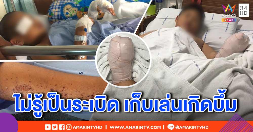 ก๊วนเด็ก 8 ขวบ เก็บ "ระเบิดปิงปอง" เล่น บึ้มมือเละ เจ็บสาหัส - ตร. ตามรวบคนทำระเบิด