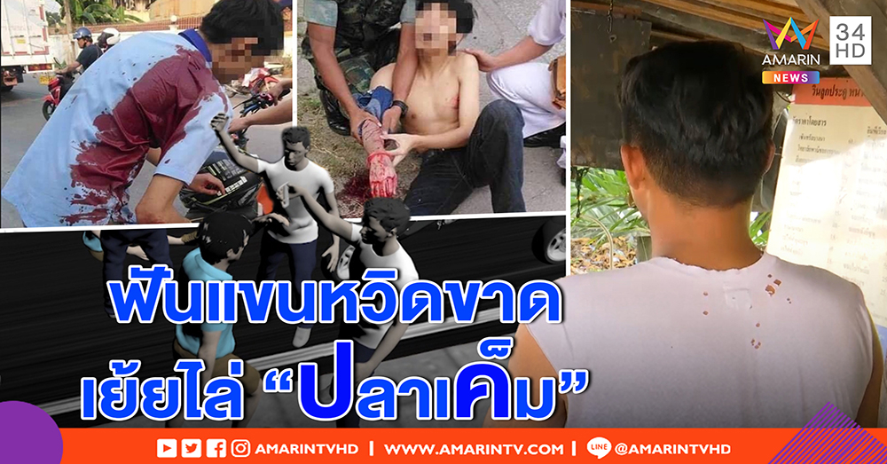 เปิดนาทีไล่ฟันระห่ำ นร.ขาสั้นดักตีเด็กช่าง ดันถูกรุมเอ็นแขนขาด ซ้ำด่า “ปลาเค็ม” (คลิป)