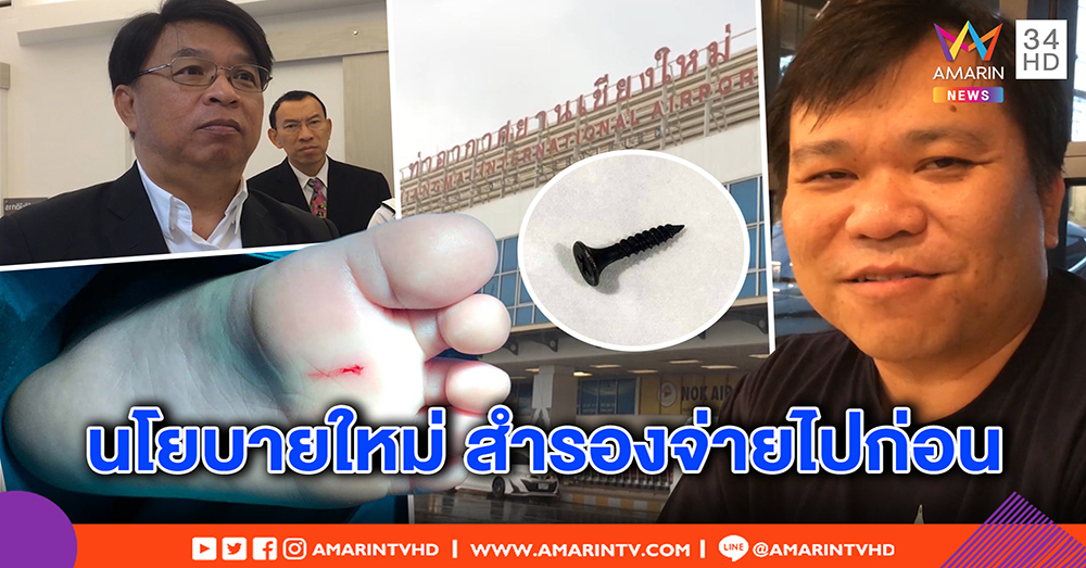 หนุ่มโวยสนามบินเชียงใหม่ ไม่ติดใจเหตุตะปูทิ่มเท้าลูก คิดค่าทำแผล เคลียร์แล้ว ผอ.โร่แจง (คลิป)