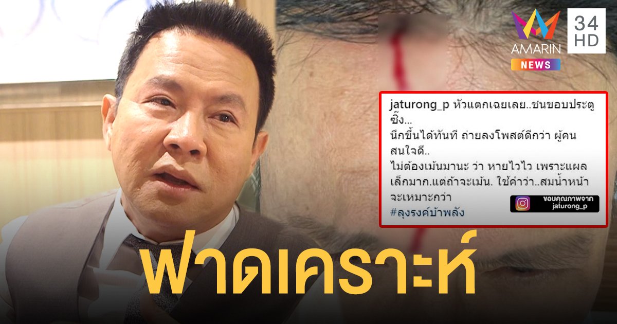 ฟาดเคราะห์รับปีใหม่! "จตุรงค์" โชคดีที่ไม่อันตรายถึงกะโหลก