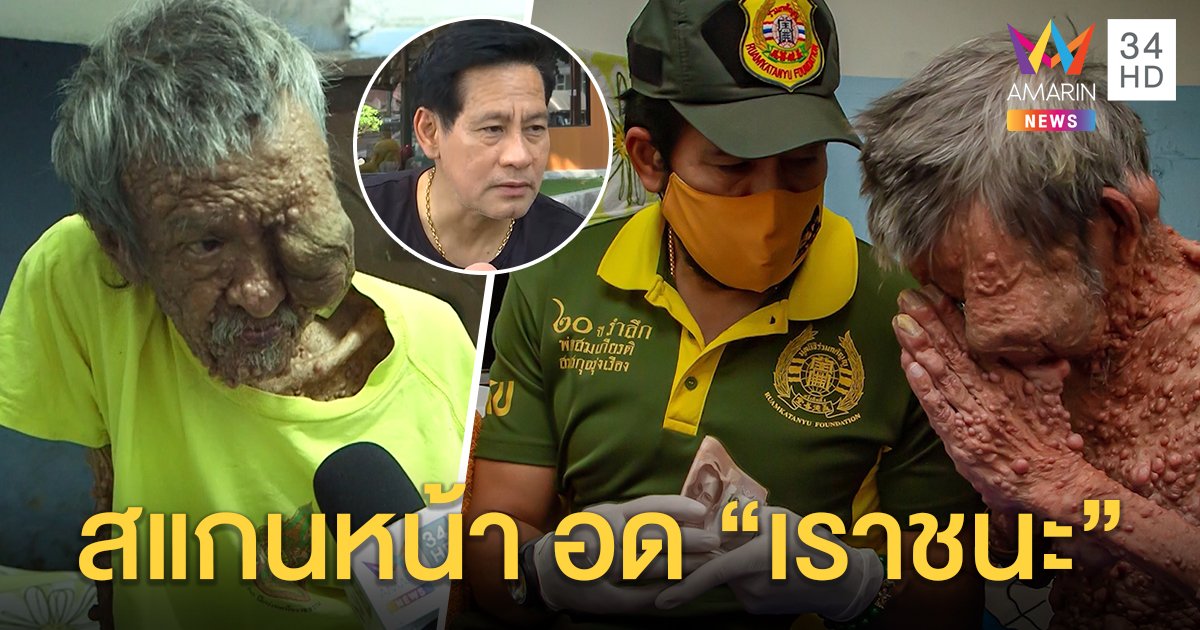 เปิดใจ “ลุงตุ่ม” ท้าวแสนปม สแกนหน้าผิดรูปชวด “เราชนะ” ท็อป - ไทด์ระดมเงินช่วย (คลิป)