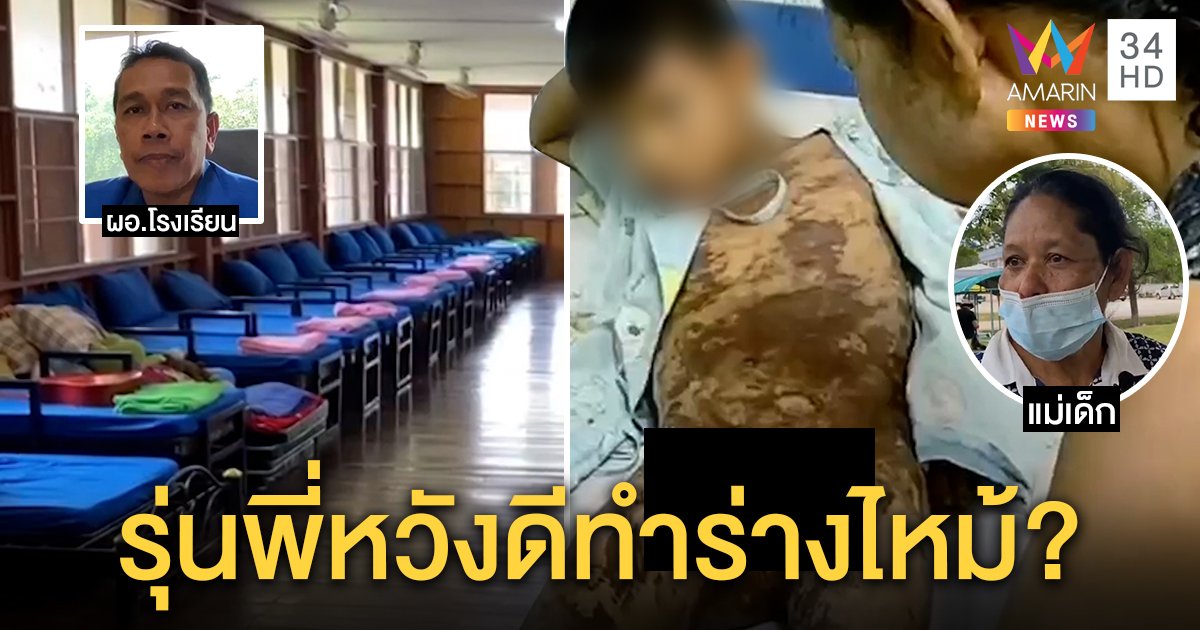 โรงเรียนแจงแล้ว! รุ่นพี่ ป.5 ราดซีม่าเด็ก 9 ขวบช่วยแก้เชื้อรา แม่โต้ยาอันตรายทำลูกเหวอะ (คลิป)