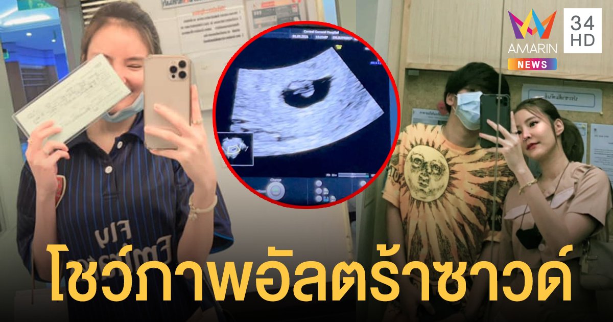 น้องเนย สายธาร อดีตแฟน เก่ง ลายพราง โชว์ภาพอัลตร้าซาวด์ ลุ้นเพศลูก พร้อมลงรูปแฟนใหม่รัวๆ