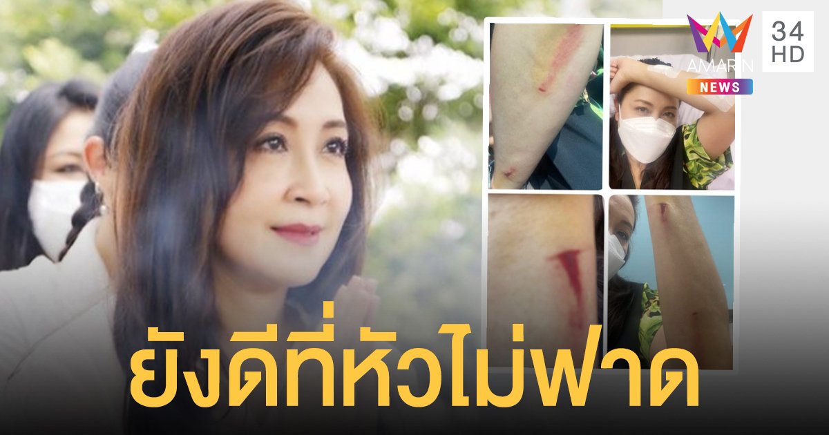 ยังดีที่หัวไม่ฟาด   กวาง กมลชนก   ขอฝากไว้เป็นอุทาหรณ์  เดินคุยโทรศัพท์พลาดลื่นตกบันได