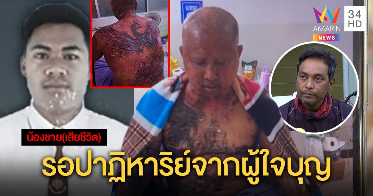 หนุ่มป่วยตุ่มน้ำพองไร้เงินรักษา เคราะห์ซ้ำน้องป่วยชิงฆ่าตัวตาย "วินัย" เชื่อปาฏิหาริย์มีจริง (คลิป)