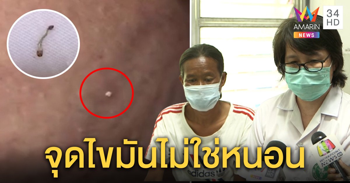 ป้าอ้างหนอนไชออกตัวที่แท้แค่ไขมัน สื่อบุกบ้านเจอไข่แมลงวันห้องไม่สะอาด (คลิป)