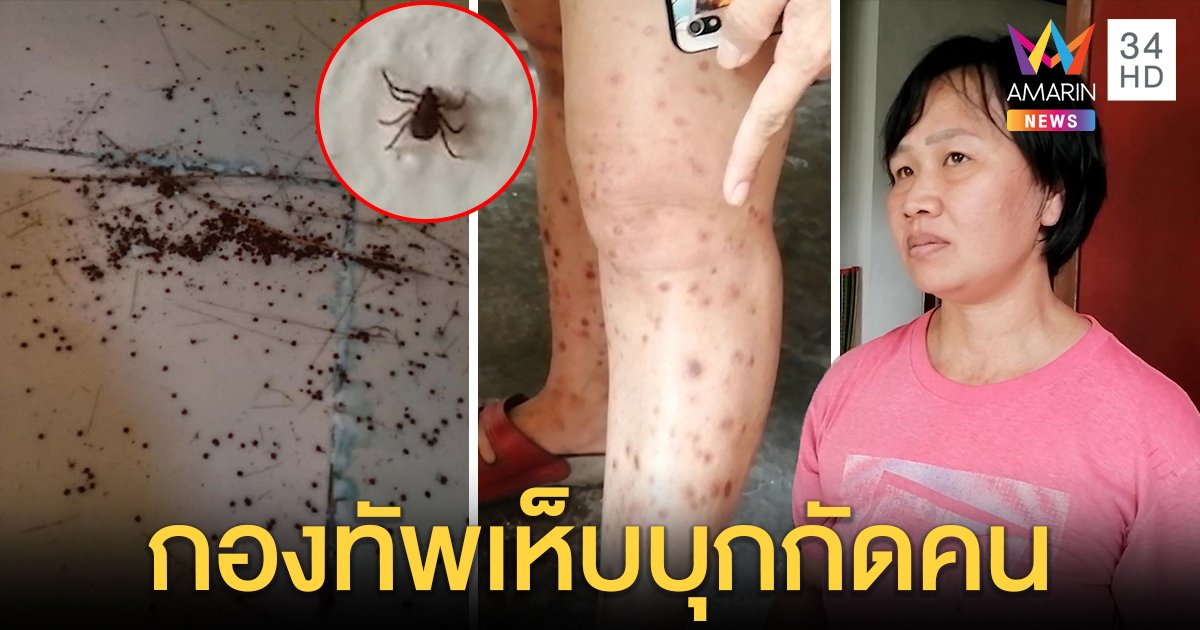 สาวโชว์ตัวลาย กองทัพเห็บรุมกัด แฉข้างห้องปล่อยซากหมาตาย อึ้งวางไข่ได้นับพัน (คลิป)