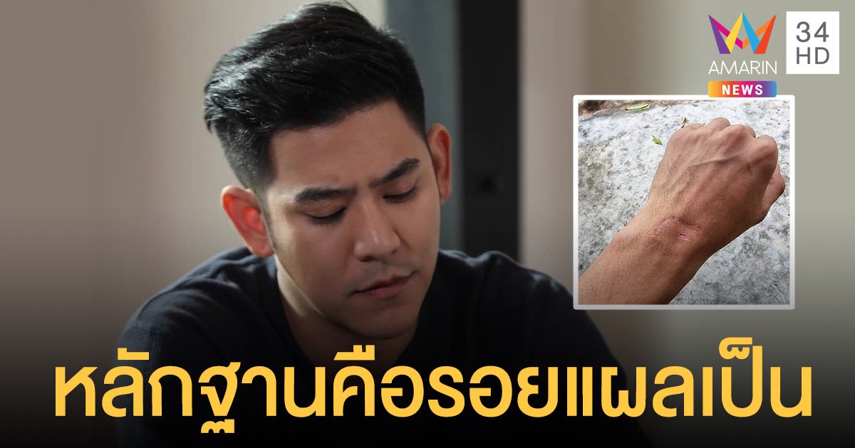 พอร์ช ศรัณย์ โชว์หลักฐานรอยแผลเป็น ลั่นแฮชแท็กกระตุกต่อมเผือก #ความจริงเมื่อปีที่แล้ว