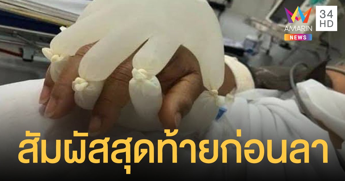 ใช้ถุงมือยางใส่น้ำ ส่งใจให้ผู้ป่วยโควิด เหมือนมีคนกุมมือก่อนจากไป