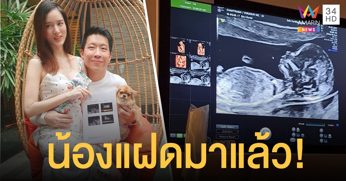 ทายาทหมื่นล้าน!  ภัทร จึงกานต์กุล ผู้ประกาศดัง แจ้งข่าวดีภรรยา จุ้มจิ้ม วรนันท์ ตั้งท้องลูกแฝดแล้ว!!