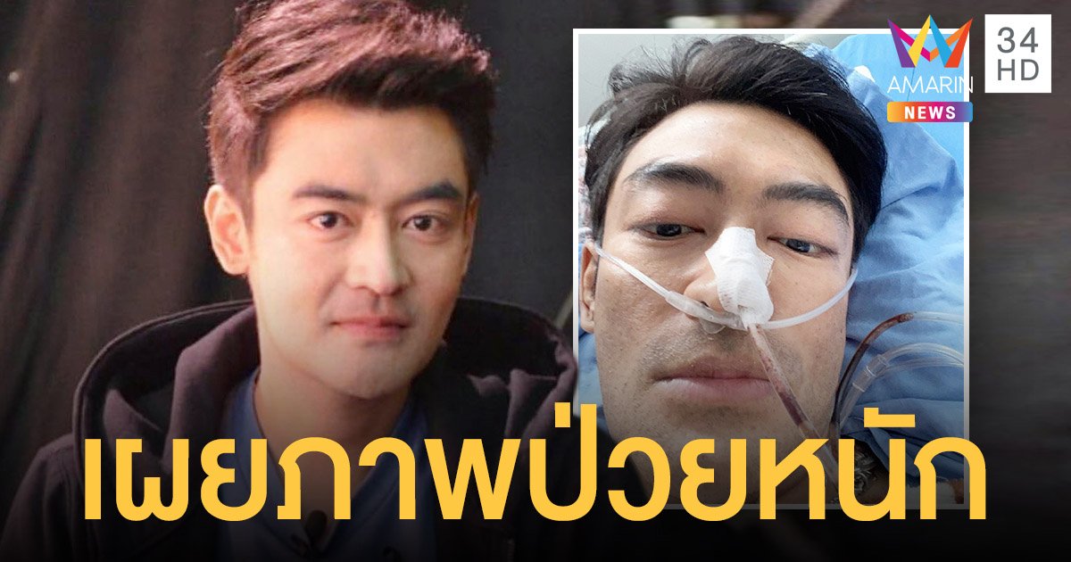 เกิดอะไรขึ้น?  เติ้ล ธนพล  เผยภาพป่วยหนัก  ใส่ท่อเข้าที่จมูก  คนแห่ให้กำลังใจเพียบ