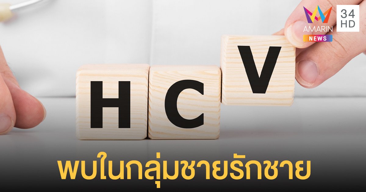 ผู้ติดเชื้อ HIV รายใหม่ เสี่ยงติดเชื้อ HCV ร่วม มากกว่า 90% พบในกลุ่มชายรักชาย