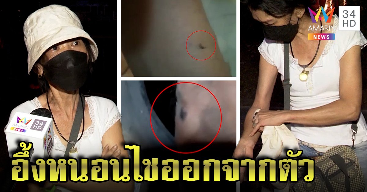 สาวโชว์แมลงไชออกจากตัว อ้างทรมานเหมือนถูกกรีดร่าง "ปลา - อ๊อด" เห็นปั๊บรู้ปุ๊บ (คลิป)