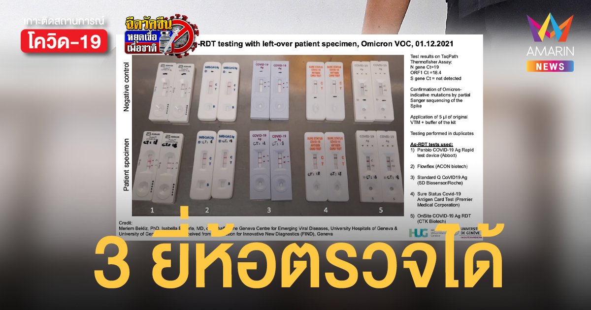 นักไวรัสวิทยาเผย ไทย มี ATK 3 ยี่ห้อตรวจวัด โอไมครอน จากคนไข้ได้