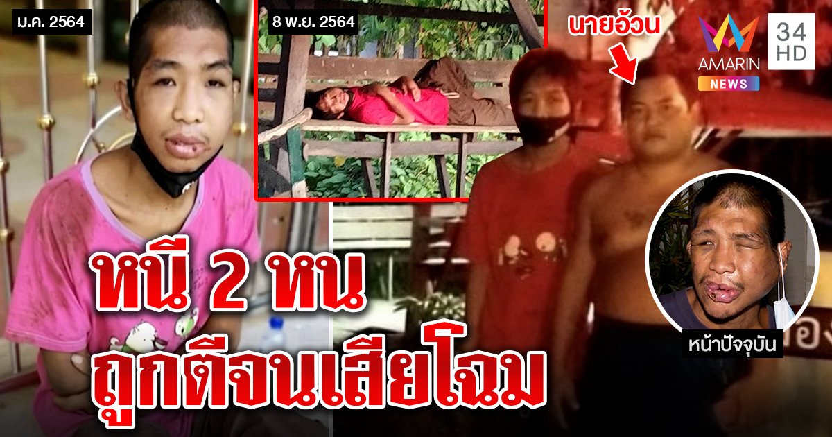 ช็อก! เผยภาพลับ "ฟ้า" หนีเจ๊กั้งหน 2 ถูกตีหน้าเสียโฉม คนพาเข้าขุมนรกคือไอ้อ้วน (คลิป)