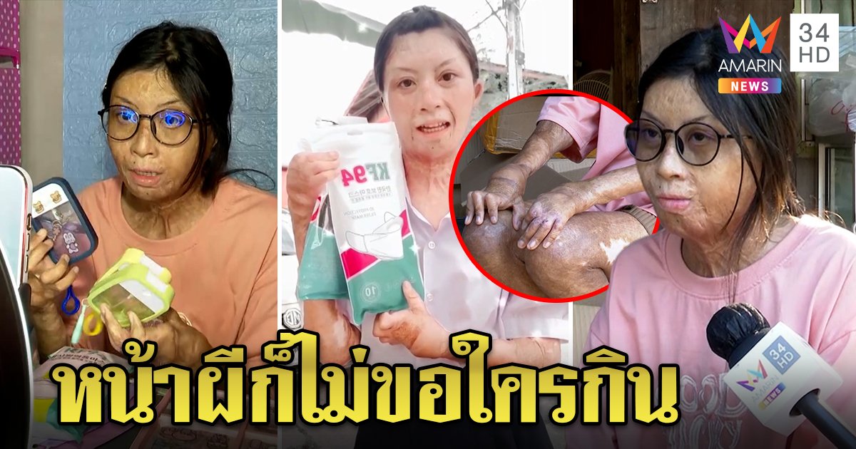 สู้ชีวิต! สาวเหยื่อพลุระเบิดไลฟ์สดขายแมสก์เลี้ยงชีพ หัวใจเหล็กไม่ท้อคนด่าหน้าผี (คลิป)