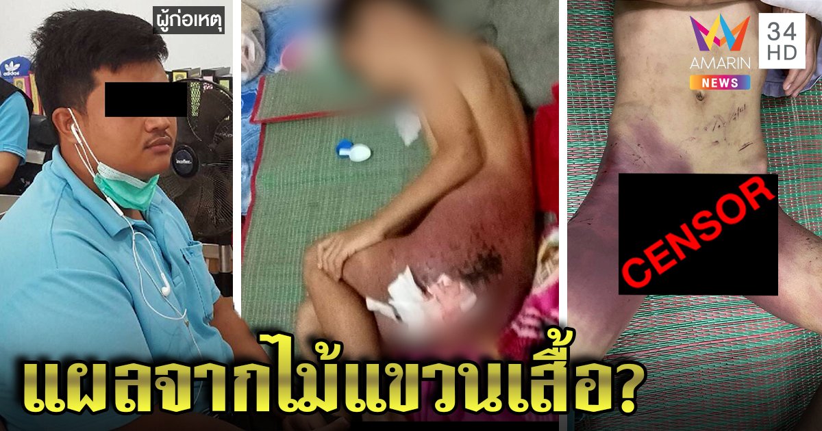 รวบพ่อเลี้ยงโหดฟาดลูก 6 ขวบโคม่า ปากแข็งไม้แขวนเสื้อตีเบา ๆ แม่เครียดติดร่างแห (คลิป)