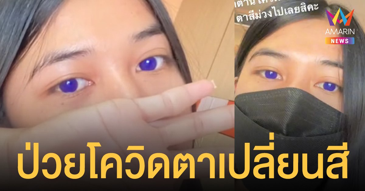 หมอไขคำตอบ ป่วยโควิด กินยาฟาวิพิราเวียร์ ตากลายเป็นสีม่วงอมน้ำเงิน อันตรายหรือไม่?