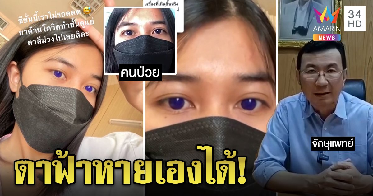สาวผวาป่วยโควิดกินยาฟาวิฯ ทำลูกตาฟ้า หมอปัดเสี่ยงบอด ชี้เป็นผลข้างเคียงหาสาเหตุไม่ได้ (คลิป)