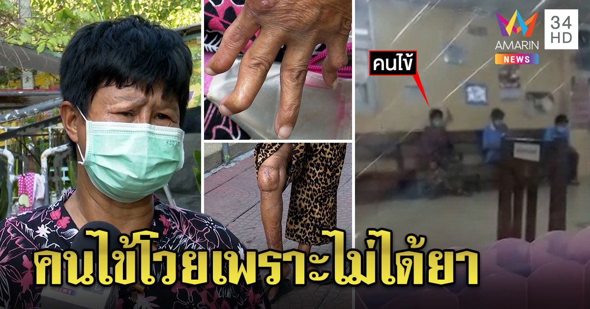 คนไข้ฉุน! พยาบาลถ่ายรูปแผลเชื้อราส่งหมอ แต่ปัดรักษาอ้างโควิด จ่อเอาผิดคนถ่ายคลิปประจาน (คลิป)