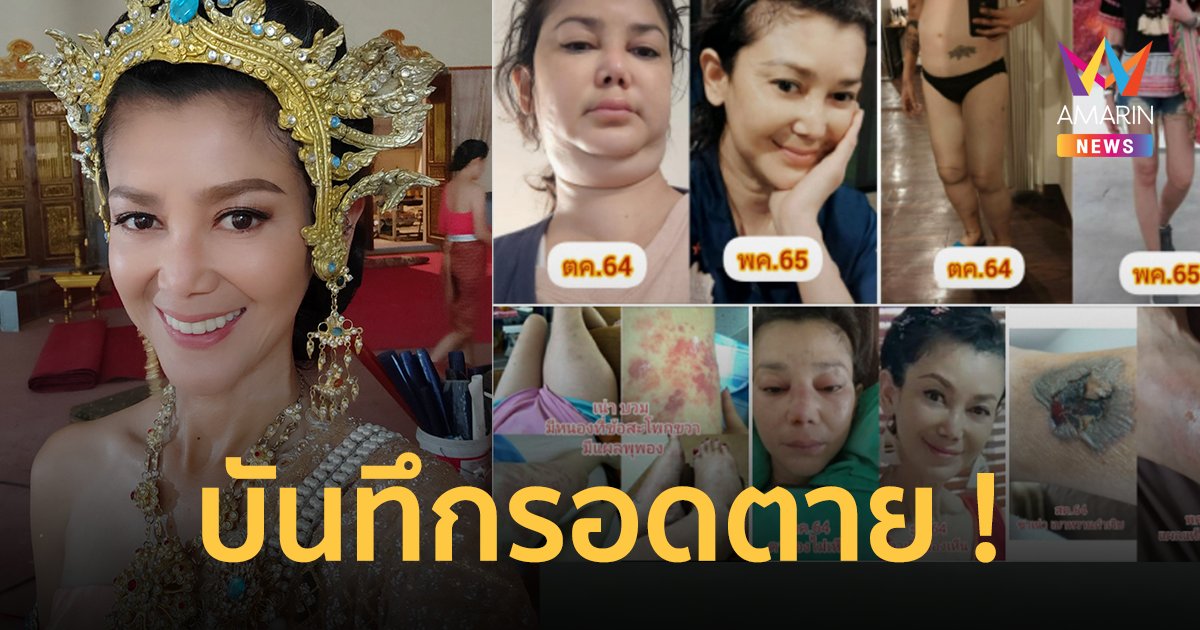 "เอ๋ อัจฉรา" เผยบันทึกถึงลูก เล่าเหตุการณ์รอดตาย จากหลายโรครุมเร้า