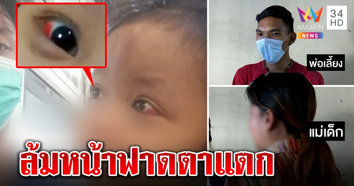 แฉพ่อเลี้ยงโหดซ้อมลูก 3 ขวบตาแตก เมียป้องผัวใหม่รักเด็ก โต้เจ็บเพราะล้มเอง (คลิป)