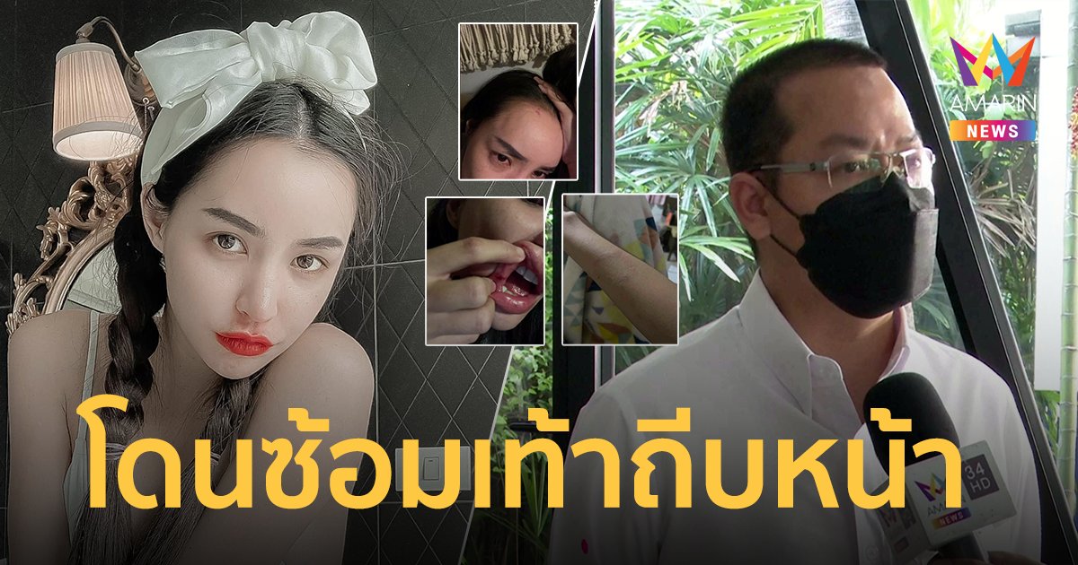 นิวนิว เอวเด้ง แจ้งความเอาผิด เติ้ล ธนพล โดนซ้อม-เท้าถีบหน้า ทนายไพศาล เผยความคืบหน้าคดี