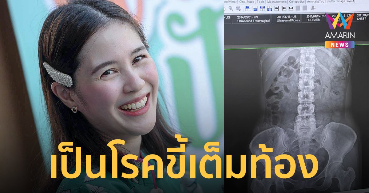 ตุ๊กตา จมาพร แสงทอง เผยเป็นโรคขี้เต็มท้อง เล่าประสบการณ์เป็นวิทยาทาน