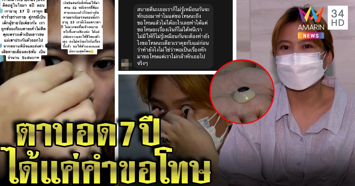 สาวควักลูกตาเทียมโชว์ ทุกข์ 7 ปีถูกอดีตแฟนซ้อมจนบอดซ้ำไม่เยียวยา แฉแชตเพิ่งขอโทษ (คลิป)