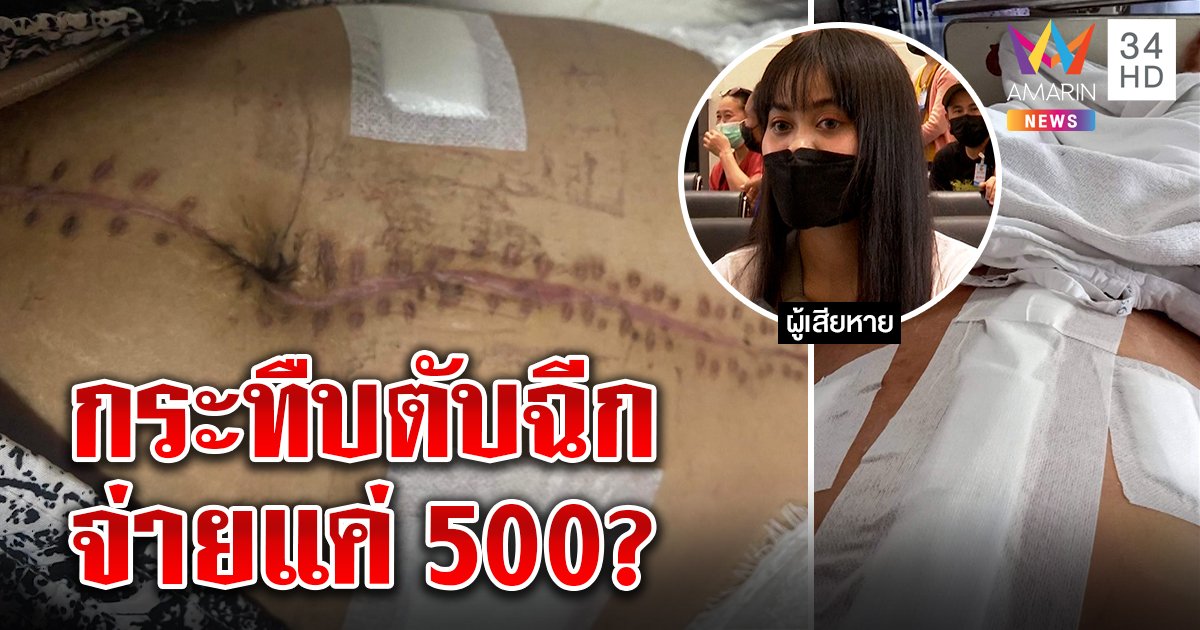 ผัวเก่าหึงโหดกระทืบสาวตับแตกม้ามฉีก เหยื่อผวาขู่ทำร้ายซ้ำ แฉจ่าย 500 จบคดี (คลิป)