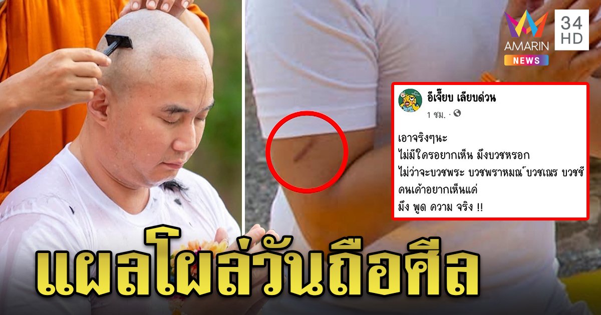 เอ๊ะนั่นอะไร! แผลโผล่บนตัวปอ “อีเจี๊ยบ” เดือดจี้สารภาพดีกว่าถือศีล (คลิป)