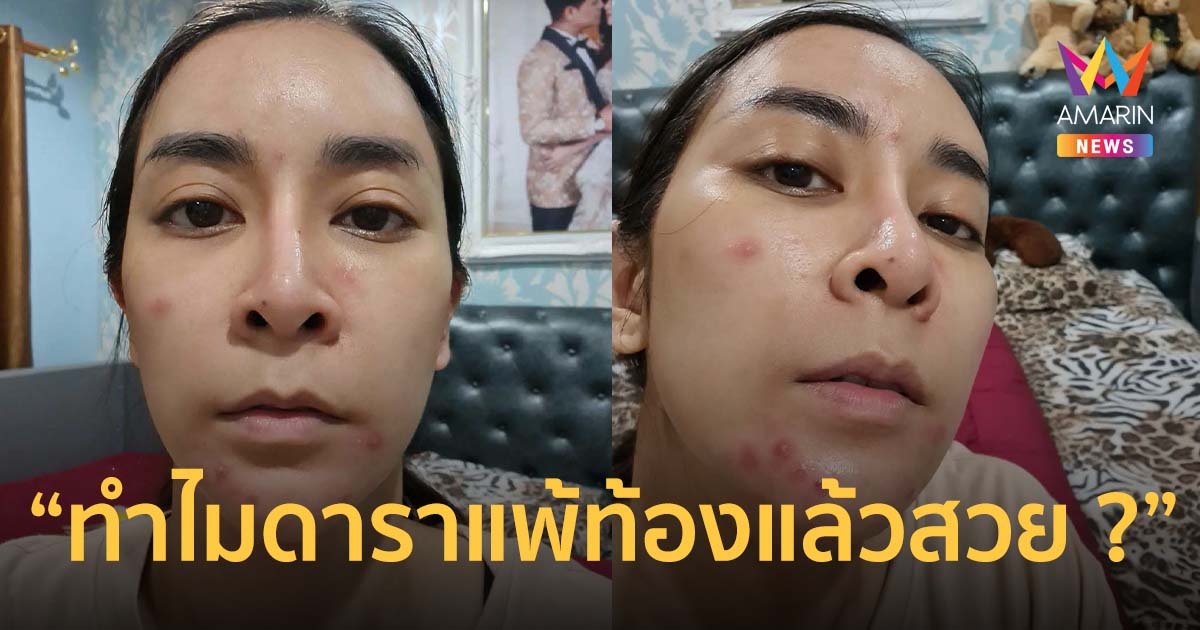 ใหม่ สุคนธวา โชว์หน้าสดท้อง 2 ลั่นทำไมดาราคนอื่น แพ้ท้องแล้วสวย ?
